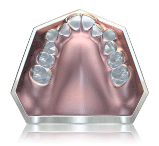Orthodontics(MYOBRACE) Orthodontics(MYOBRACE)
