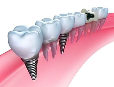 State of the art dental technology