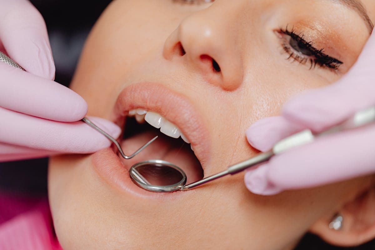 Can I Get Dental Implants If I Have Bone Loss?